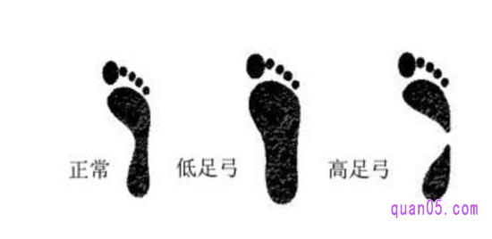 在选择运动鞋之前,先要确定自己的脚型