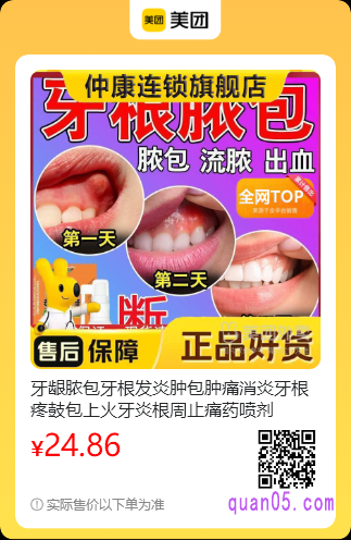 牙龈脓包牙根发炎喷剂美团二维码
